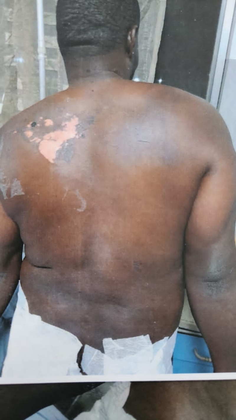 Beaten, Abandoned, Then Charged